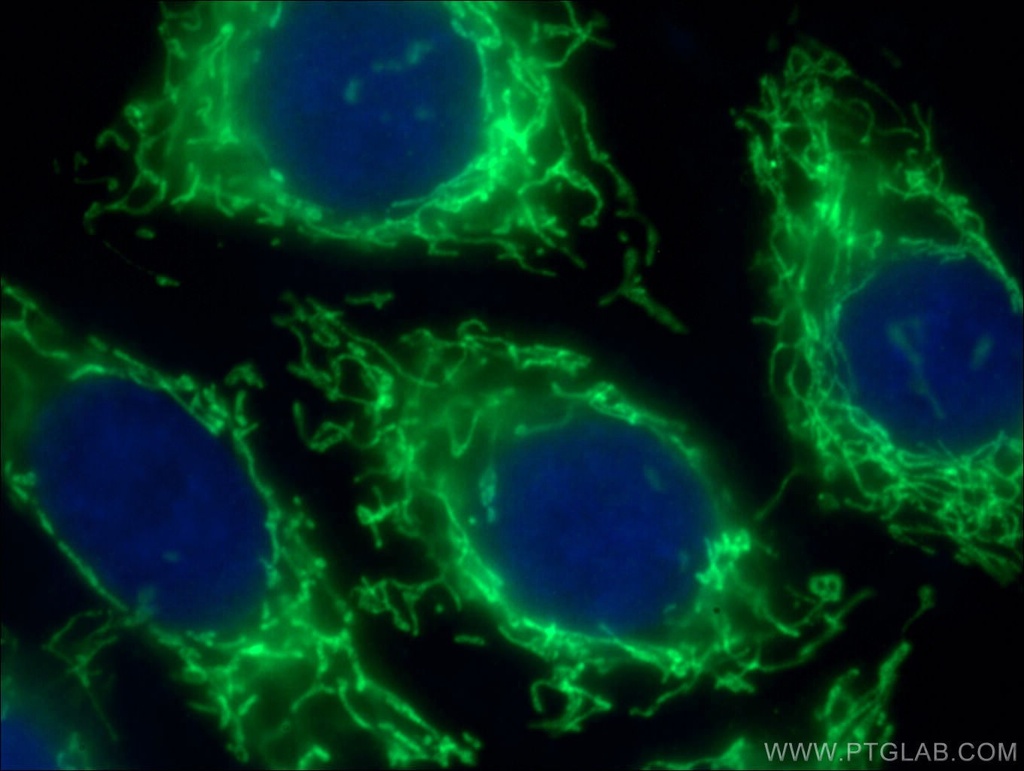 SDHA Polyclonal antibody