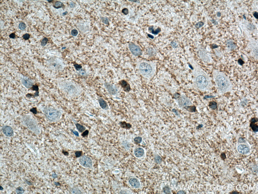 Plasmolipin Polyclonal antibody