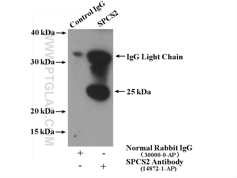 SPCS2 Polyclonal antibody