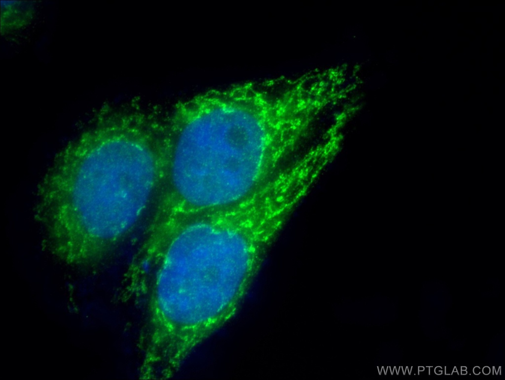 COQ9 Polyclonal antibody