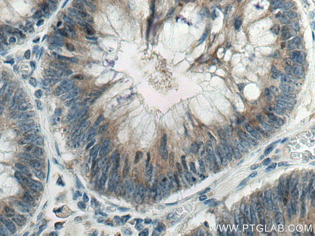 SCLT1 Polyclonal antibody