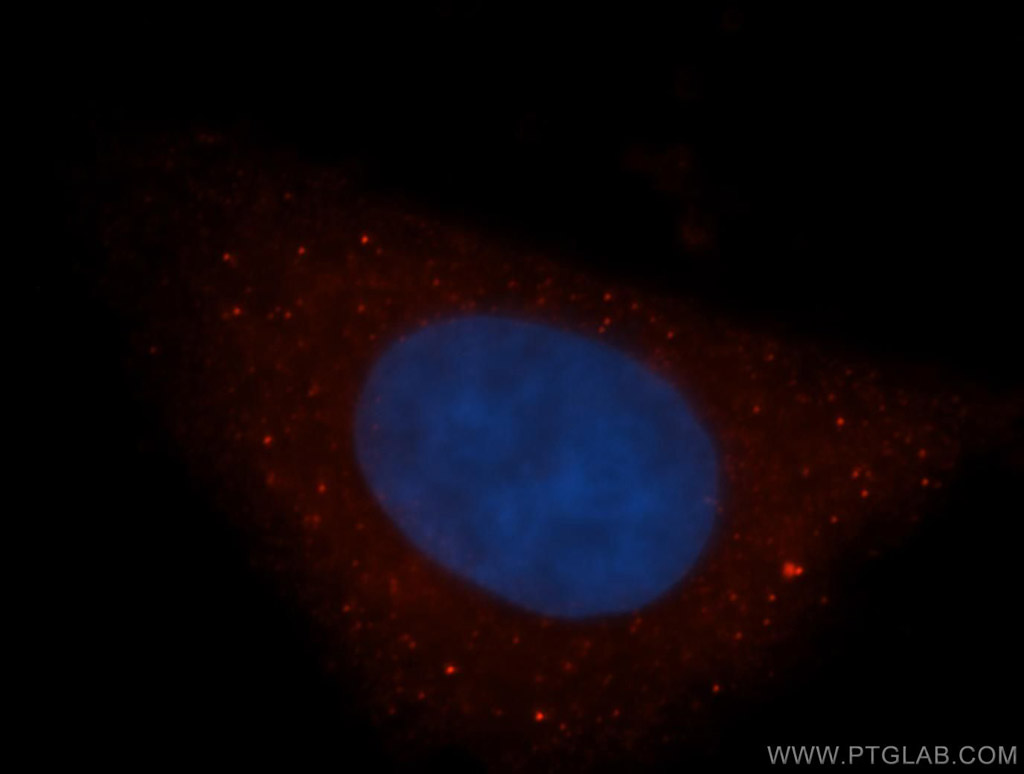 DAAM1 Polyclonal antibody