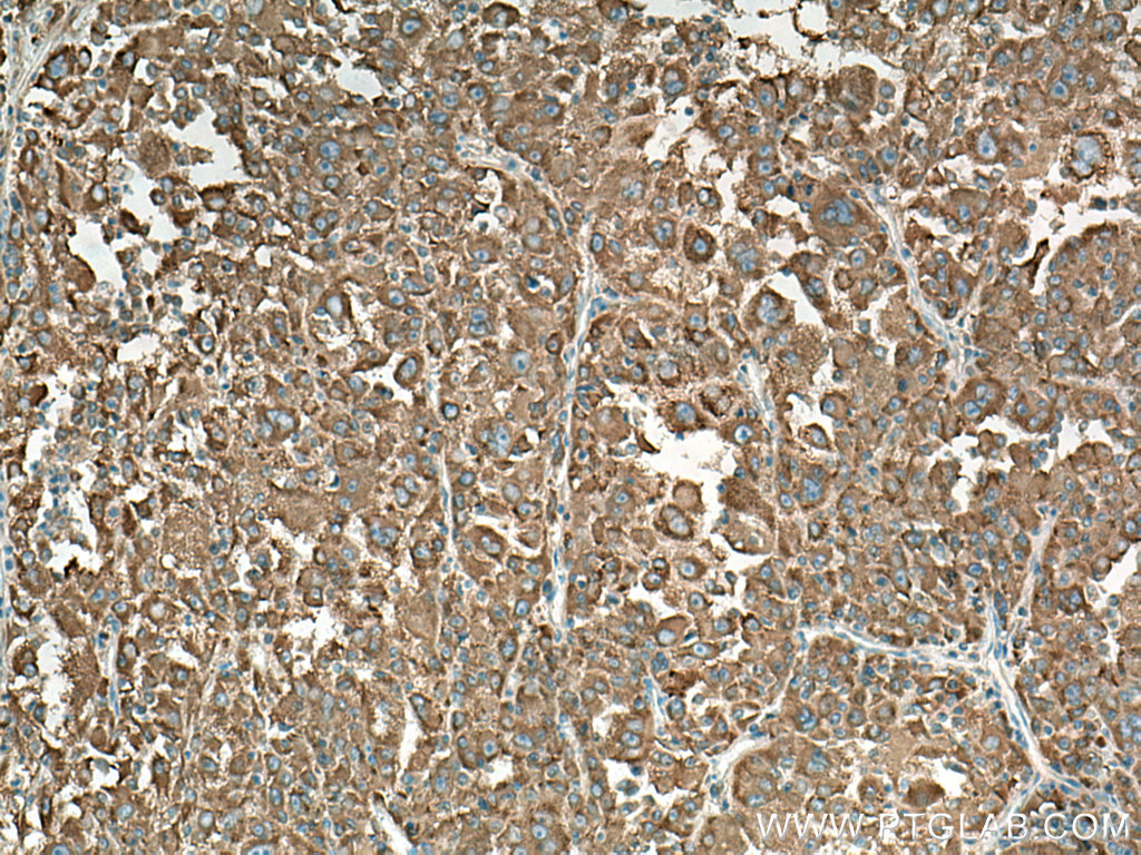 NARS Polyclonal antibody