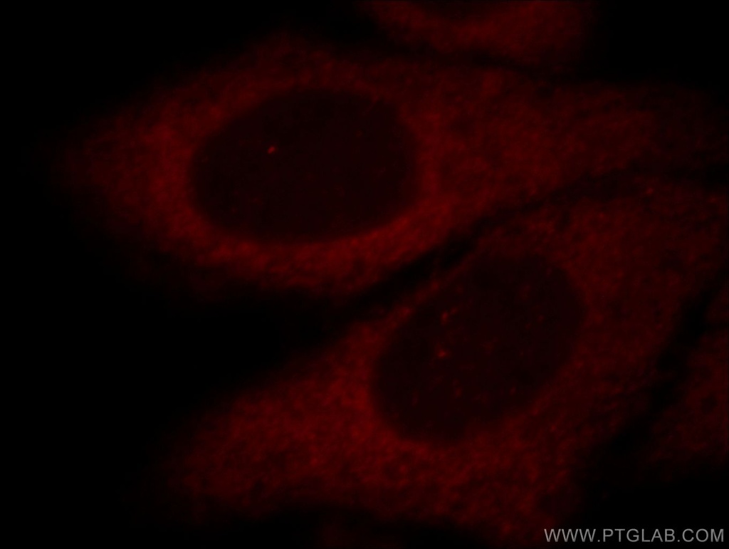 Aldolase C Polyclonal antibody