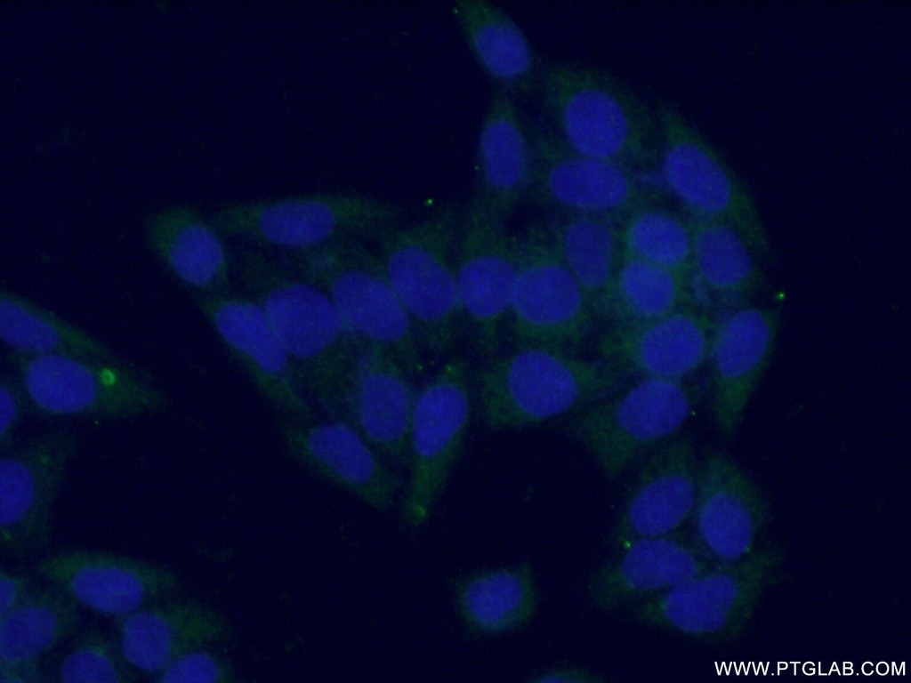 GOT1 Polyclonal antibody