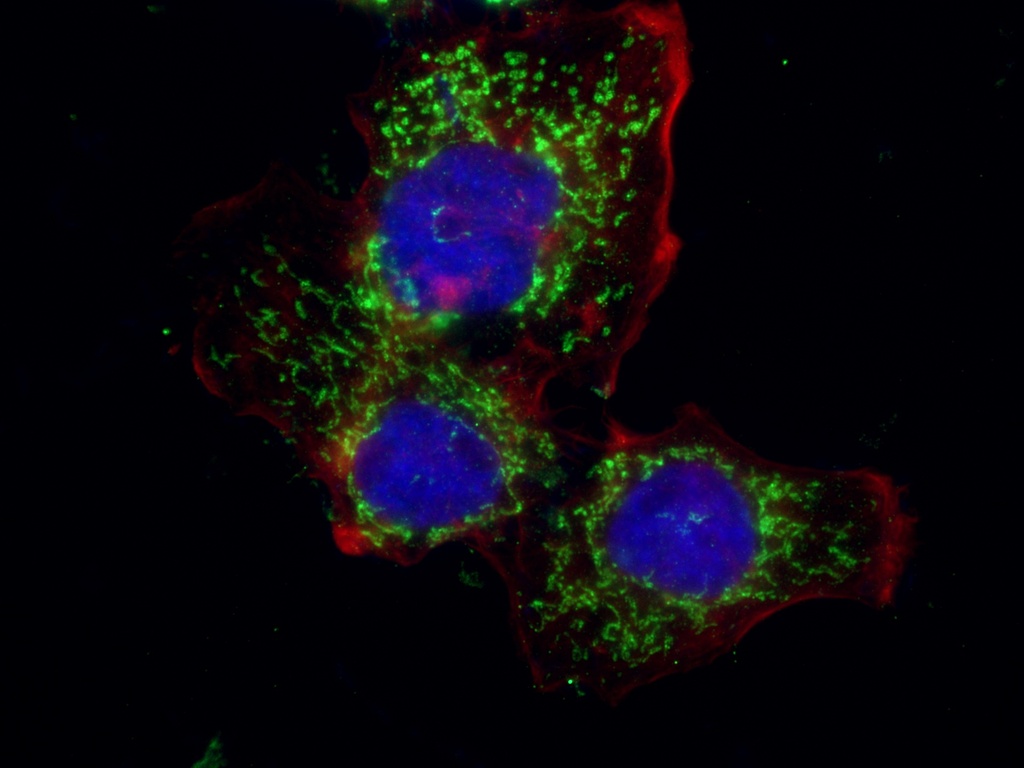 PCK2 Polyclonal antibody