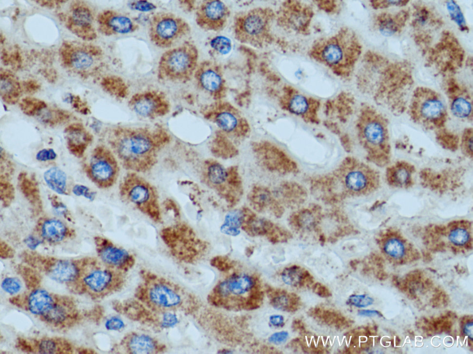 ATP5D Polyclonal antibody