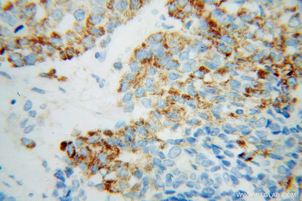 PECR Polyclonal antibody