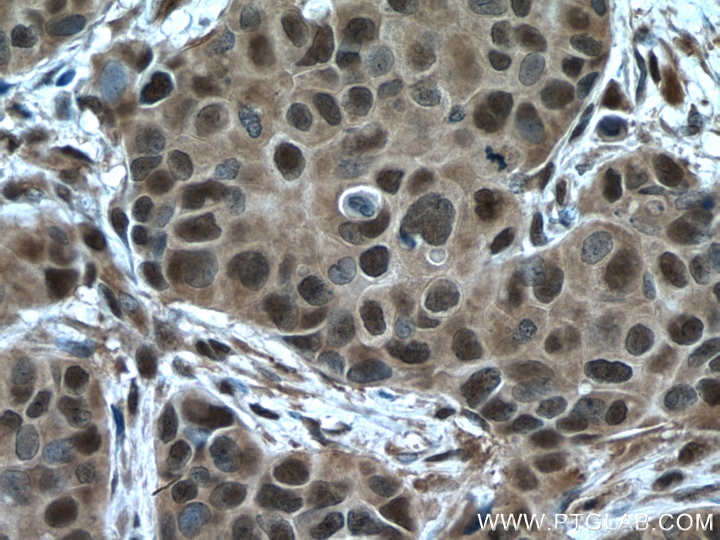 PSMC2 Polyclonal antibody
