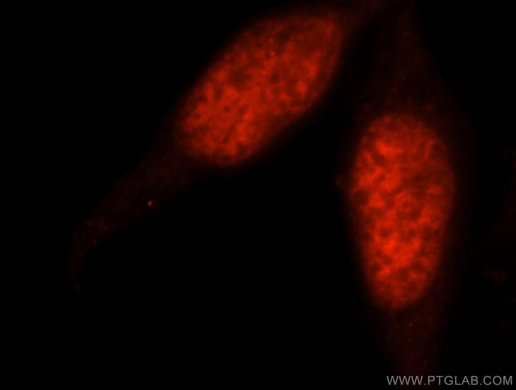 PSME3 Polyclonal antibody