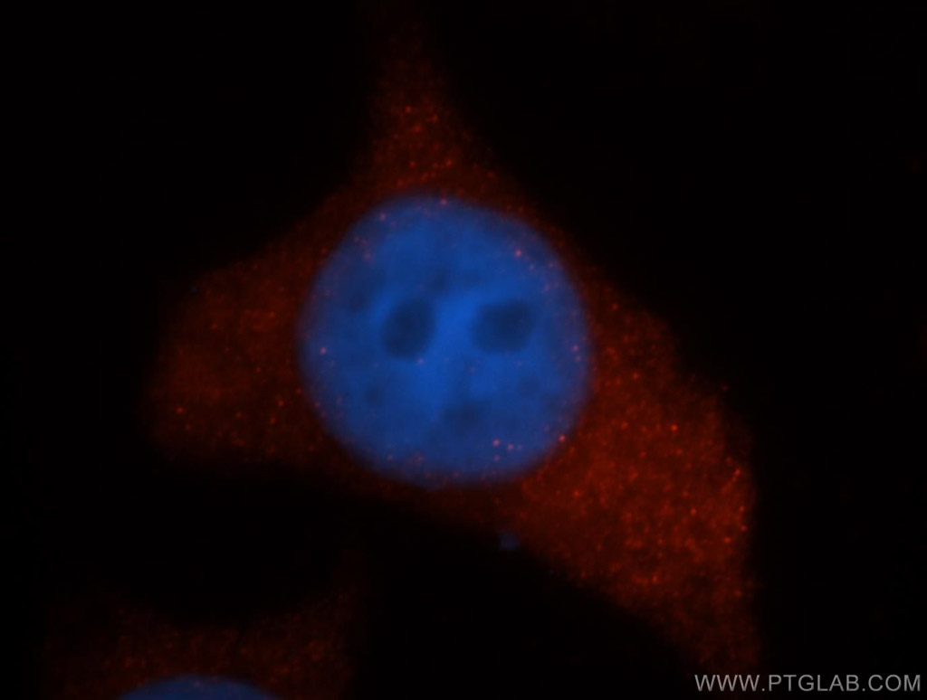 UROS Polyclonal antibody