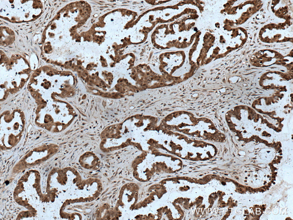 HN1 Polyclonal antibody