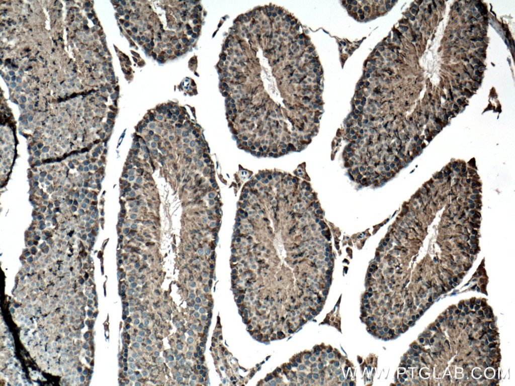 DDOST Polyclonal antibody