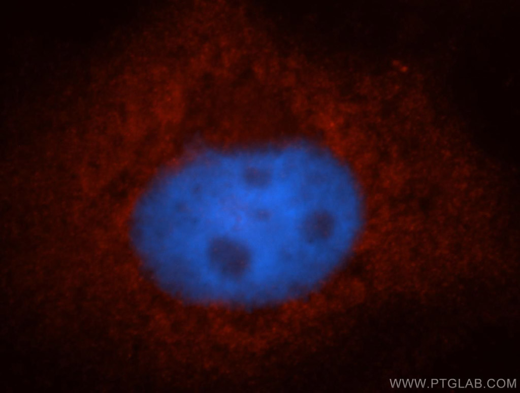 POFUT1 Polyclonal antibody