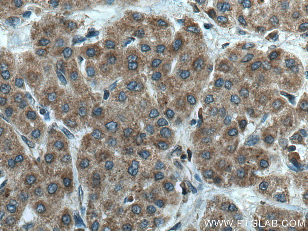GALNS Polyclonal antibody