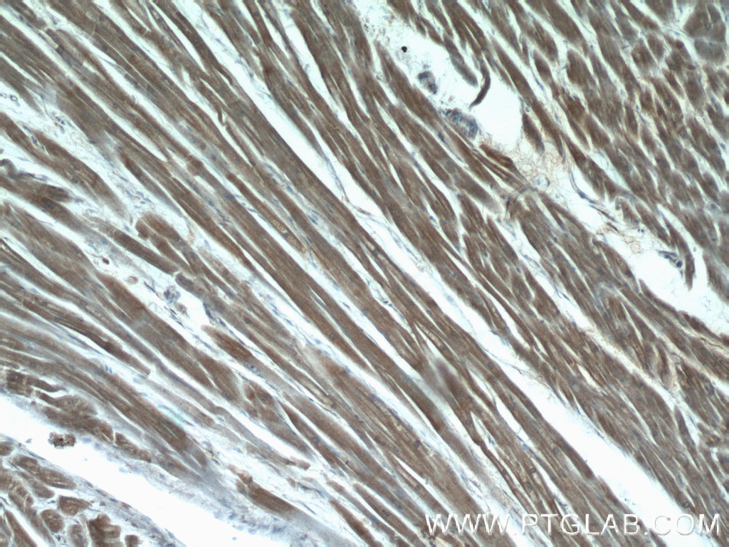LMOD3 Polyclonal antibody