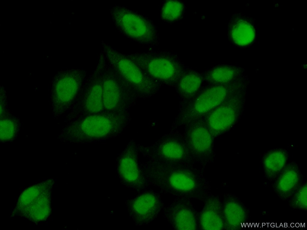 SNIP1 Polyclonal antibody