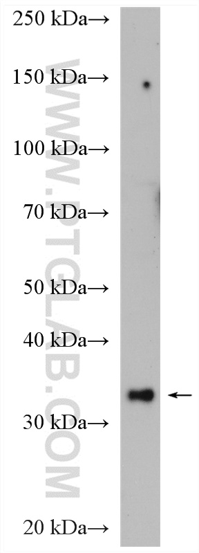 SNX11 Polyclonal antibody