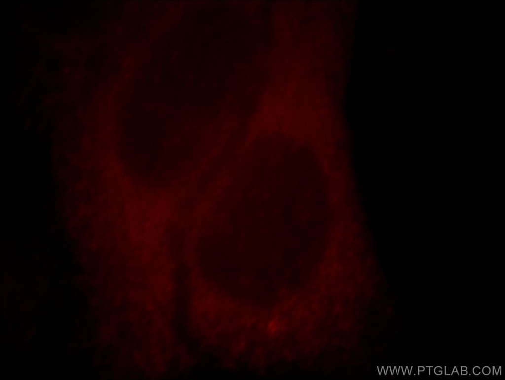Kir6.1 Polyclonal antibody