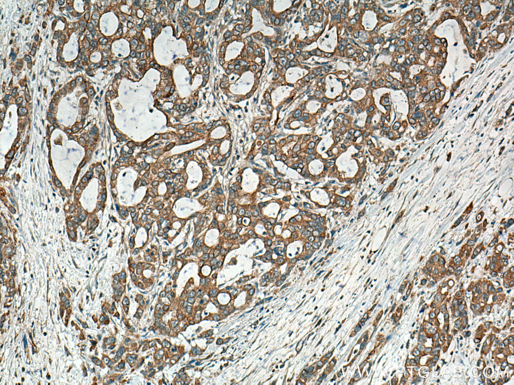 BEGAIN Polyclonal antibody