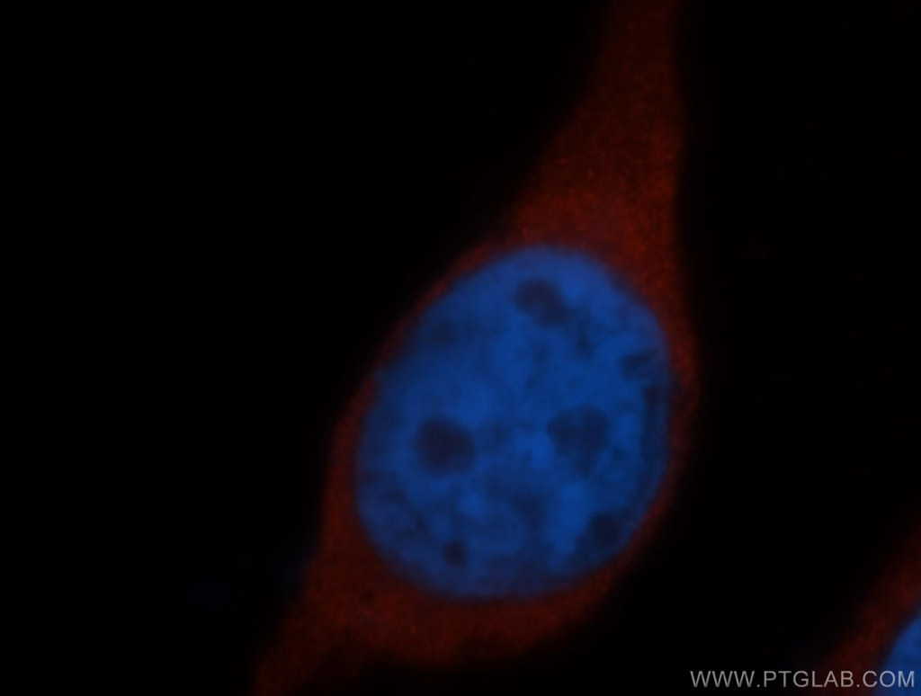 RPS15 Polyclonal antibody