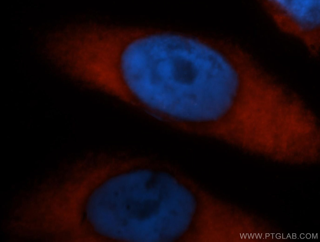 PABPC4 Polyclonal antibody