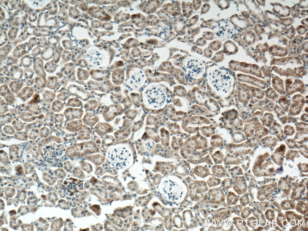 SLC25A39 Polyclonal antibody