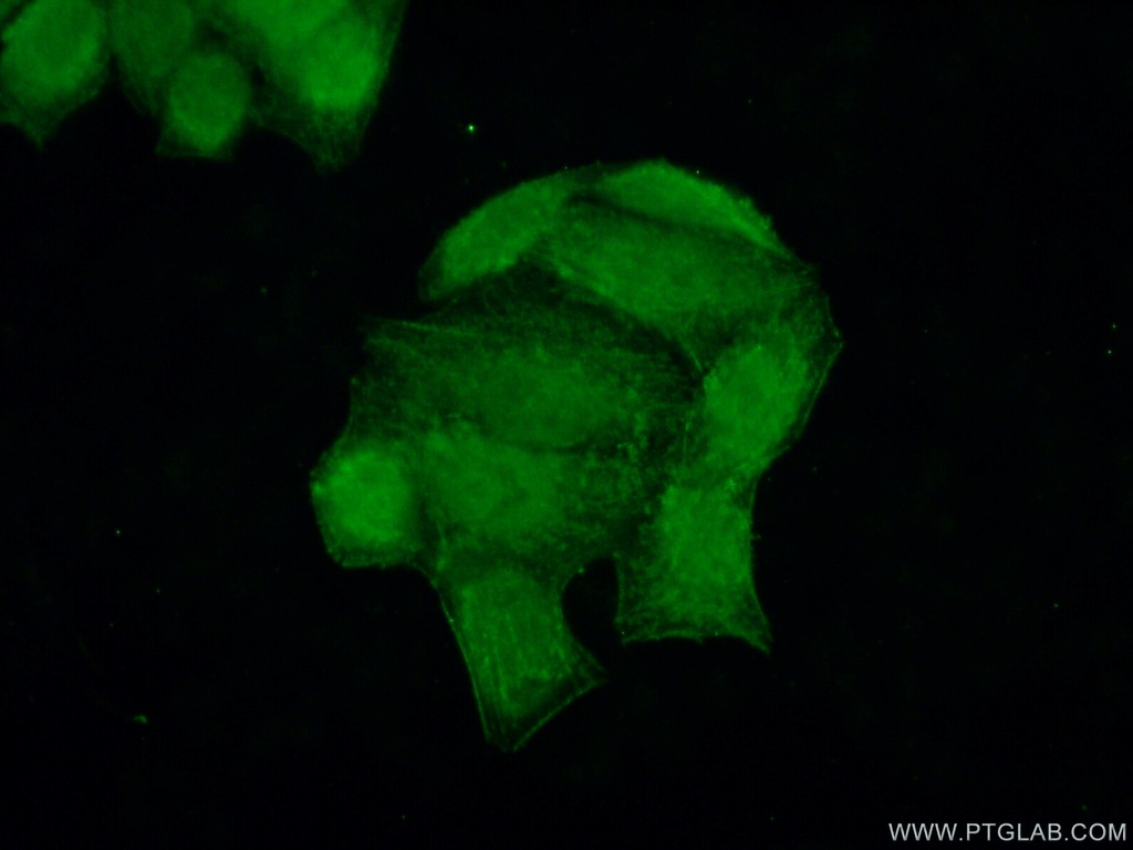 POP7 Polyclonal antibody