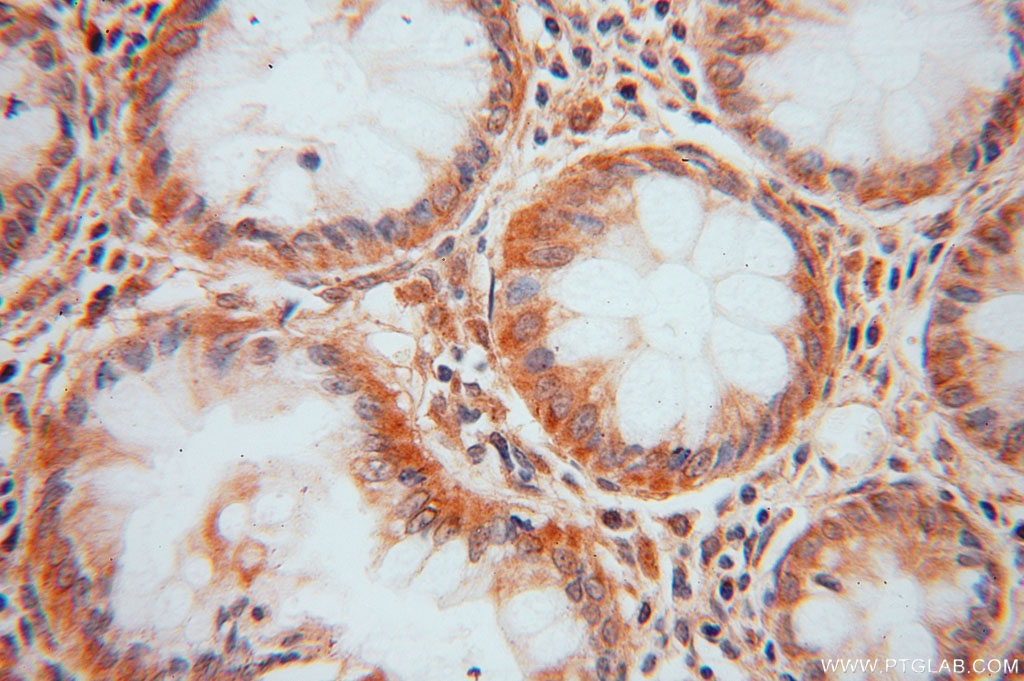 DDAH2 Polyclonal antibody