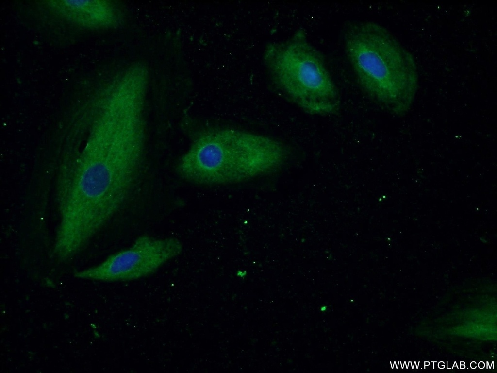 ASMTL Polyclonal antibody