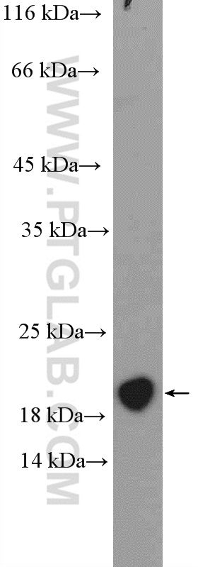 MCTS1 Polyclonal antibody