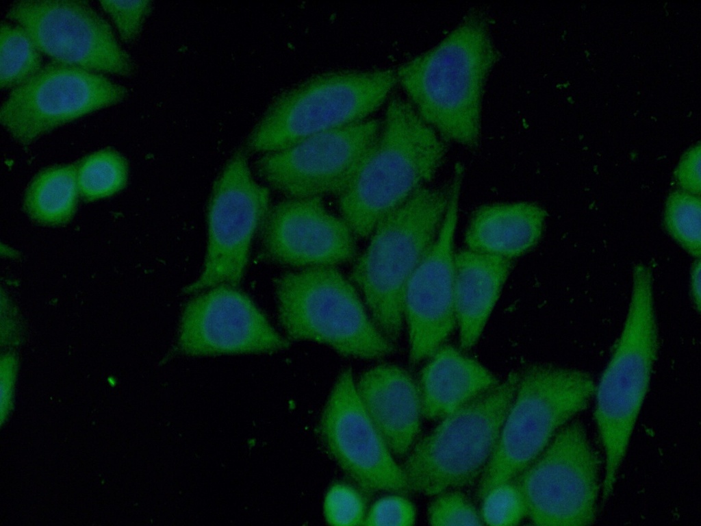 PPA1 Polyclonal antibody