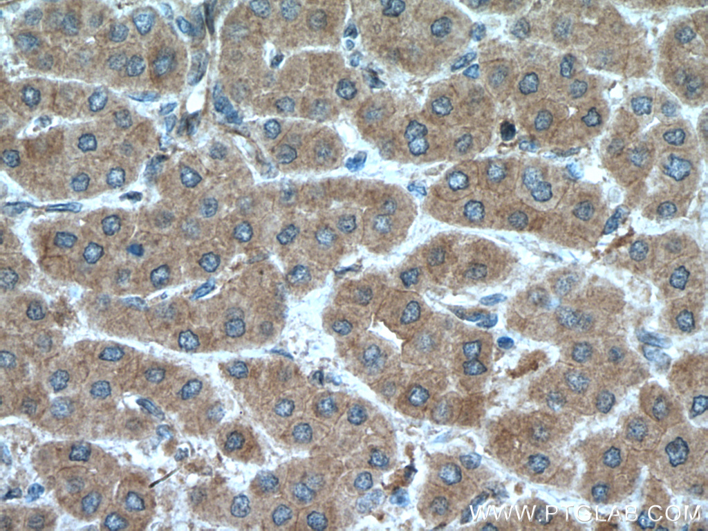 MGLL Polyclonal antibody