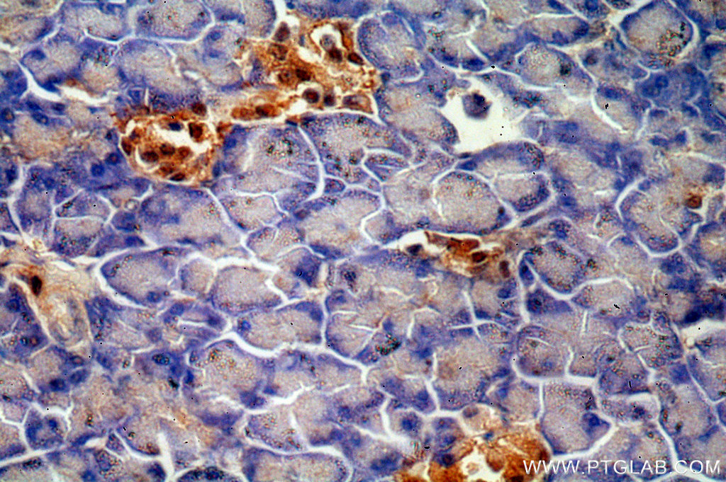 ENC1 Polyclonal antibody