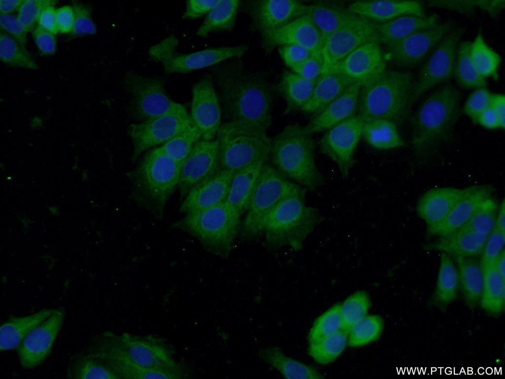 DNPEP Polyclonal antibody