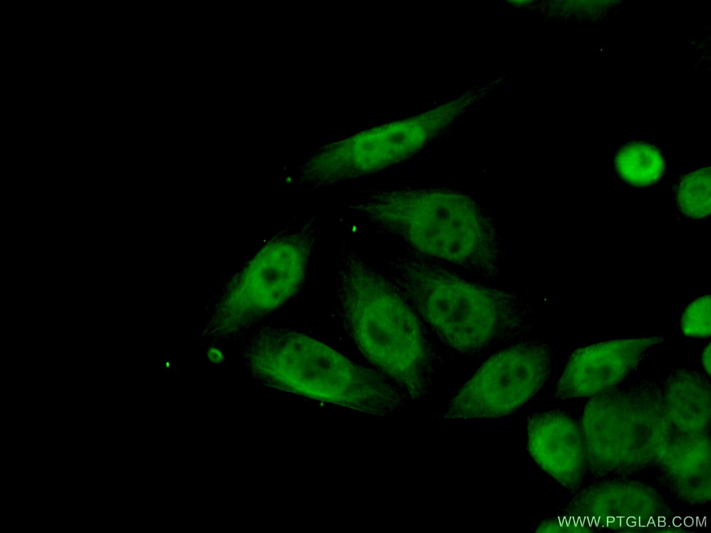 CUTC Polyclonal antibody