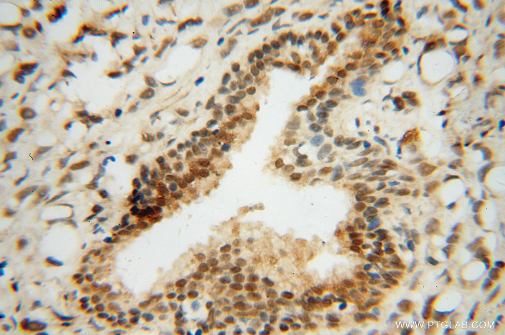 RING1 Polyclonal antibody
