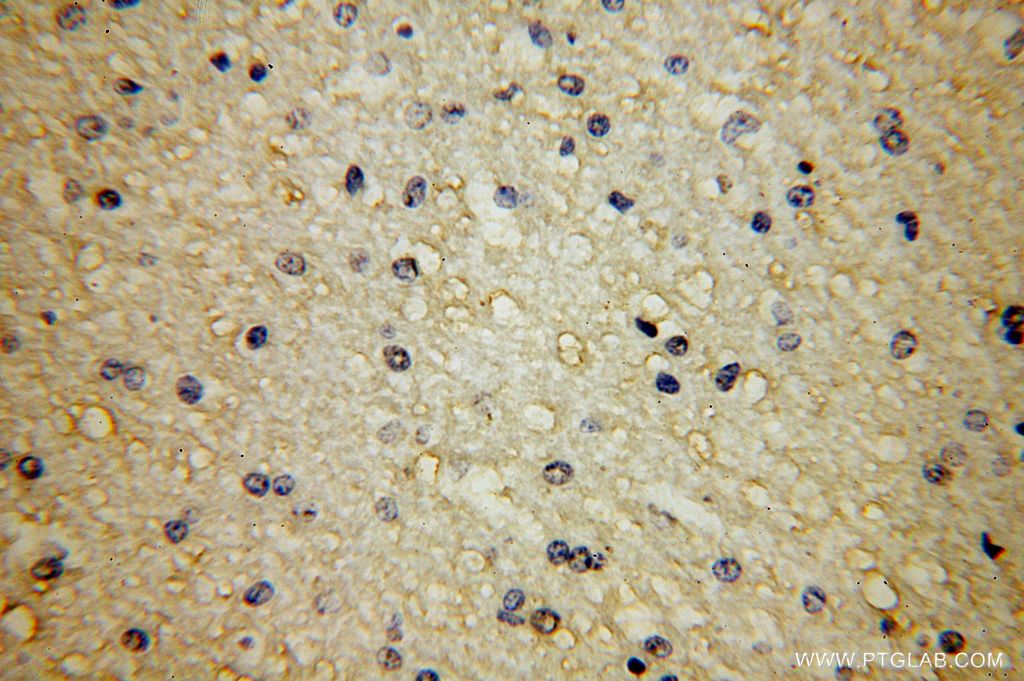 APLP2 Polyclonal antibody