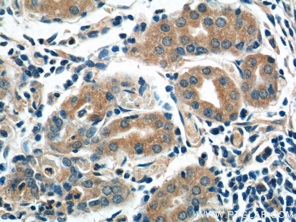 AZI2/NAP1 Polyclonal antibody