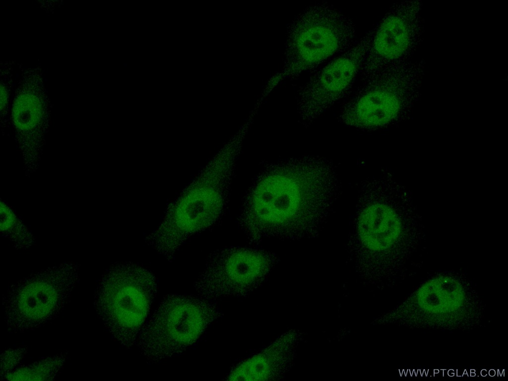 MAGEA8 Polyclonal antibody