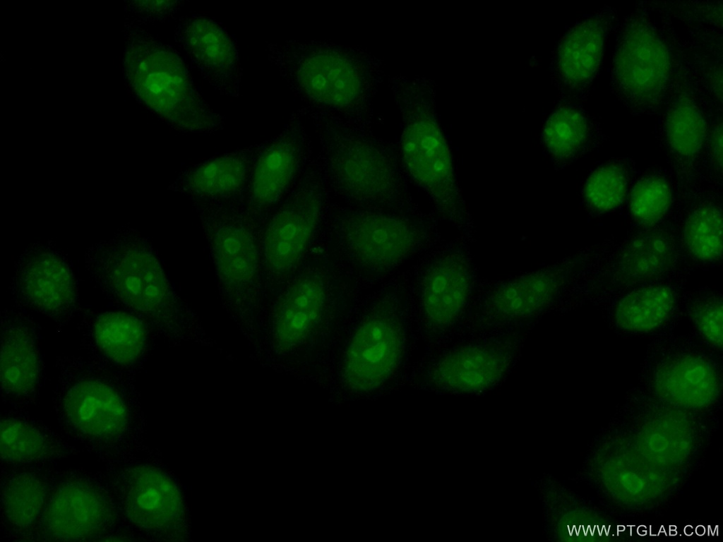 EXOSC3 Polyclonal antibody