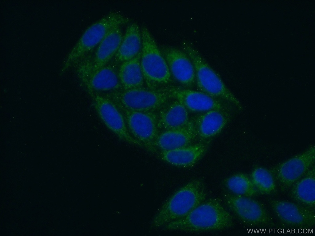 TARS2 Polyclonal antibody