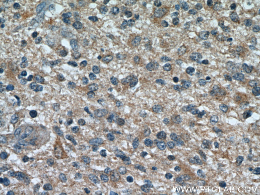 TOMM7 Polyclonal antibody
