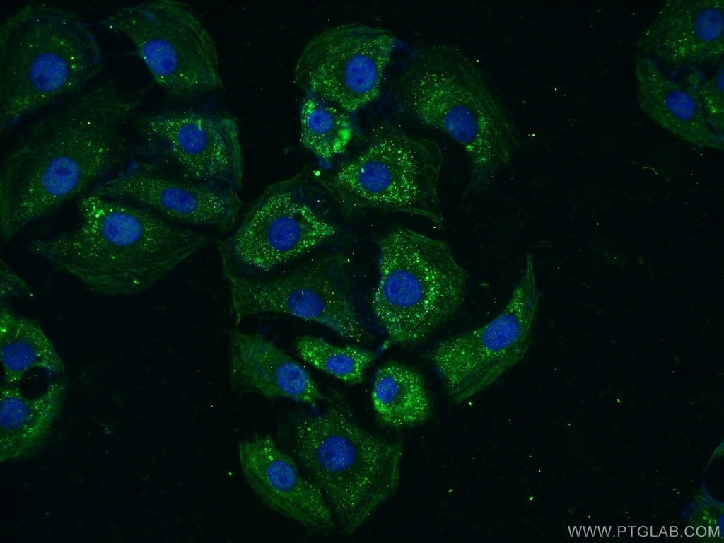 TTBK2 Polyclonal antibody