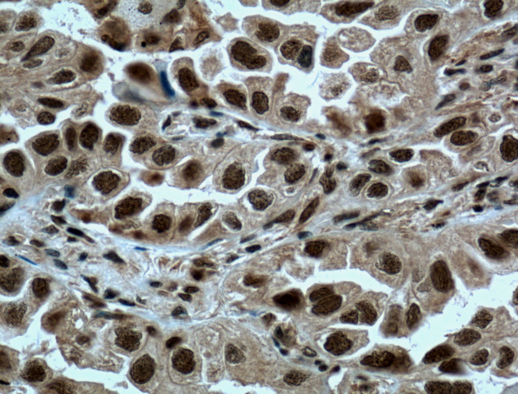 METTL3 Polyclonal antibody