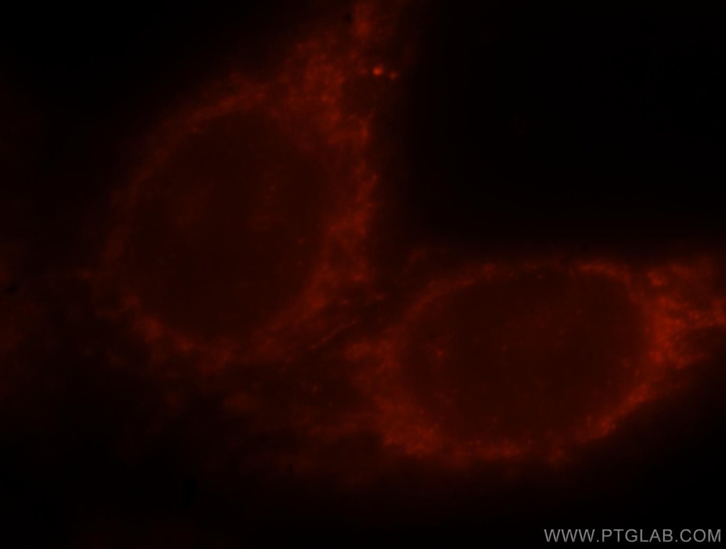PI4K2B Polyclonal antibody