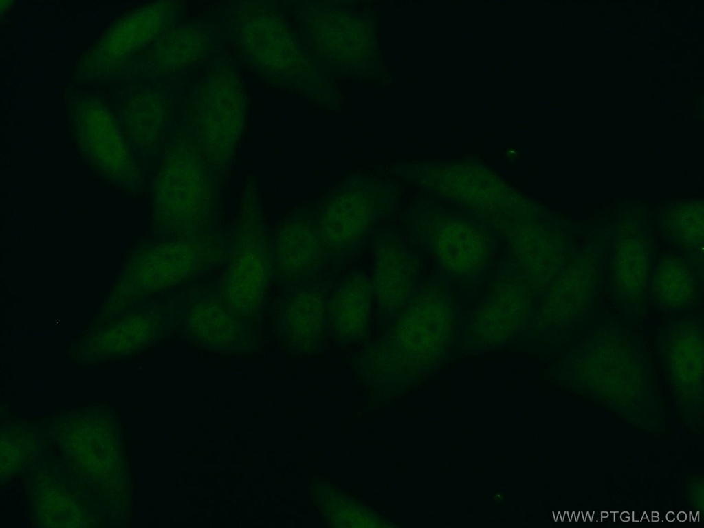 PFDN5 Polyclonal antibody