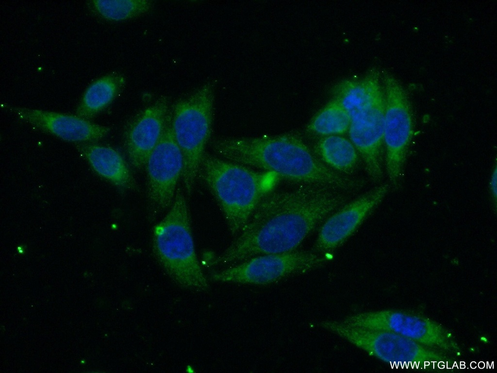 SEC61B Polyclonal antibody