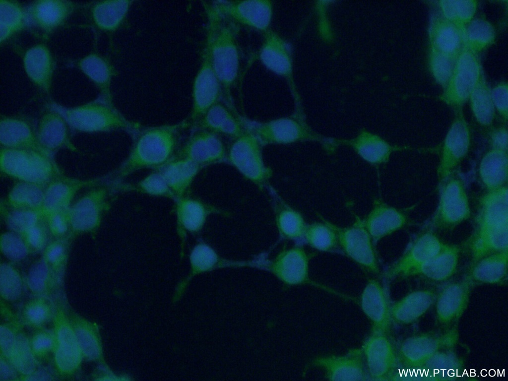 INPP5K Polyclonal antibody