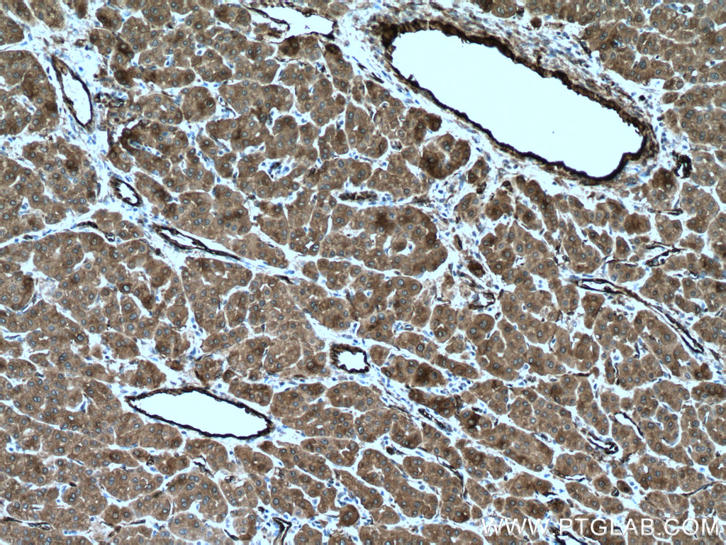 TGM2 Polyclonal antibody